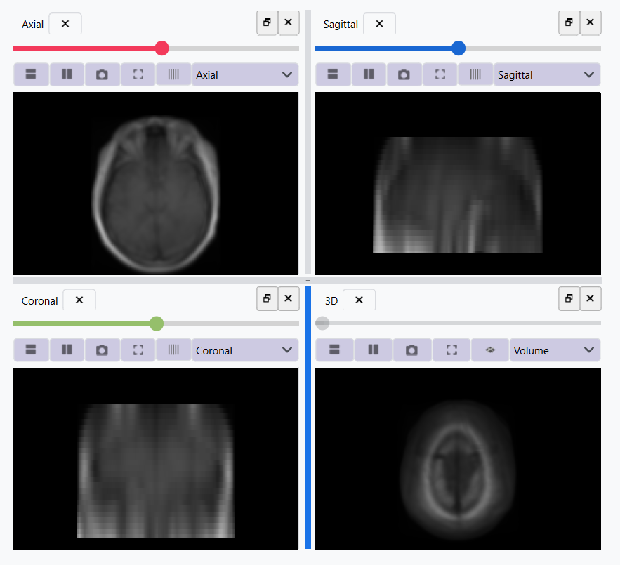 Image After Filtering