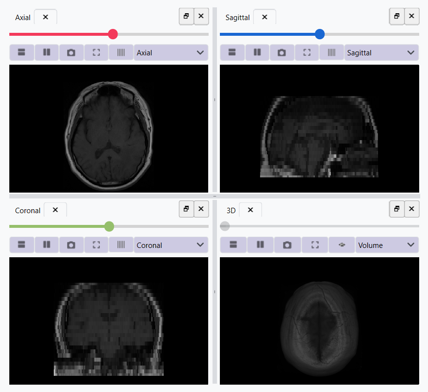 Image Before Filtering